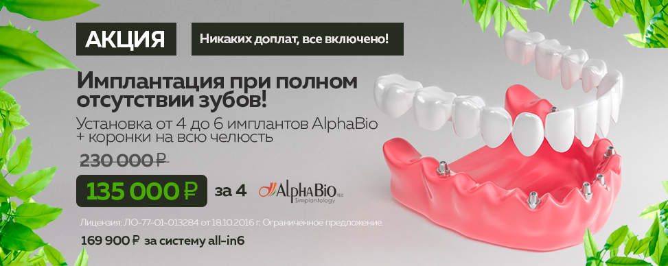 Имплантация при полной адентии зубов AlphaBio под ключ цена 135 000 рублей за одну челюсть в Москве