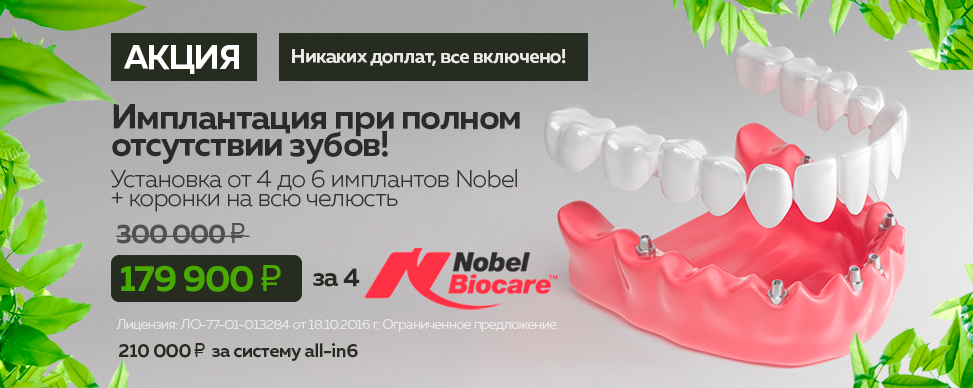 Имплантация при полной адентии зубов Nobel под ключ цена 179 900 рублей за одну челюсть в Москве