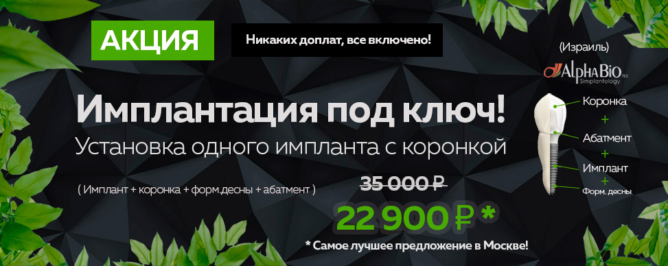 Зуб имплант цена 22900 р по акции с коронкой — лучшее предложение в Москве!