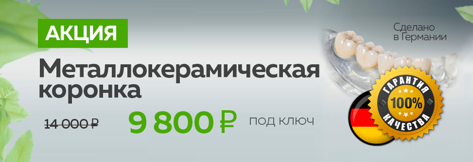 Предложение по установке коронки на зуб из металлокерамики за 9 800 рублей под ключ в стоматологии Лимон по акции!