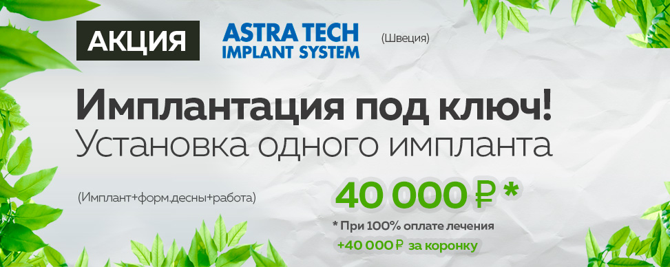 Имплантация зубов Astra Tech под ключ цена 40000 руб в Москве