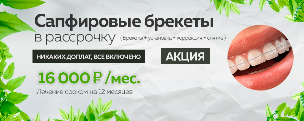 Сапфировые брекеты в рассрочку 16000 руб за одну челюсть в Москве