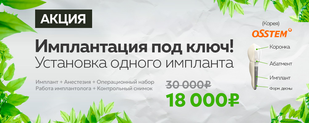 имплантация зубов osstem под ключ цена 41900 москва